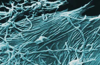 Ebola útočí už milióny rokov, súvisí s vývinom ľudoopov